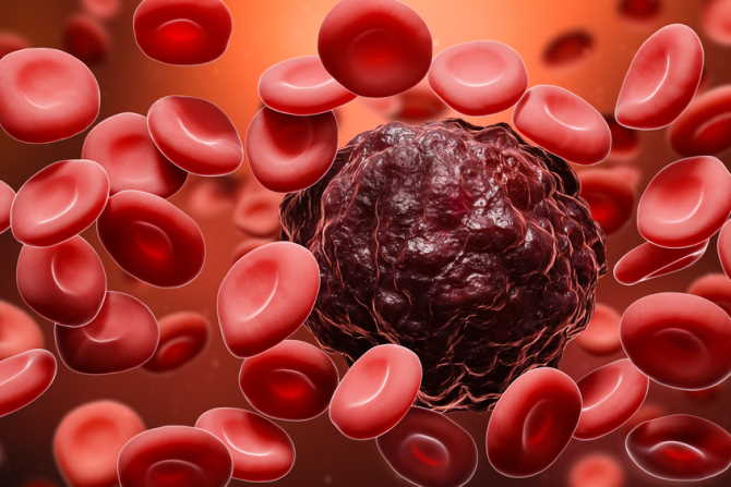 BLOOD CANCER- Causes, Symptoms & Treatment options